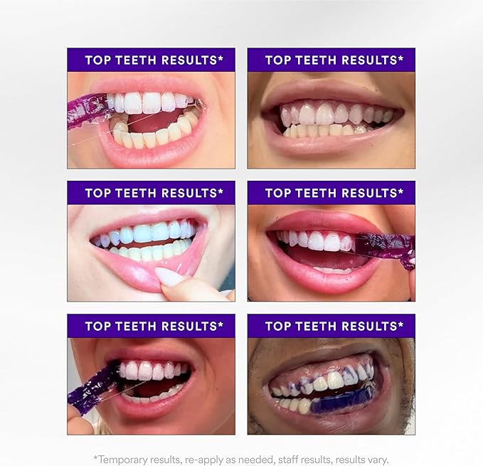 Purple Teeth Whitening Strips – 14 Treatments - Viral Drop Club